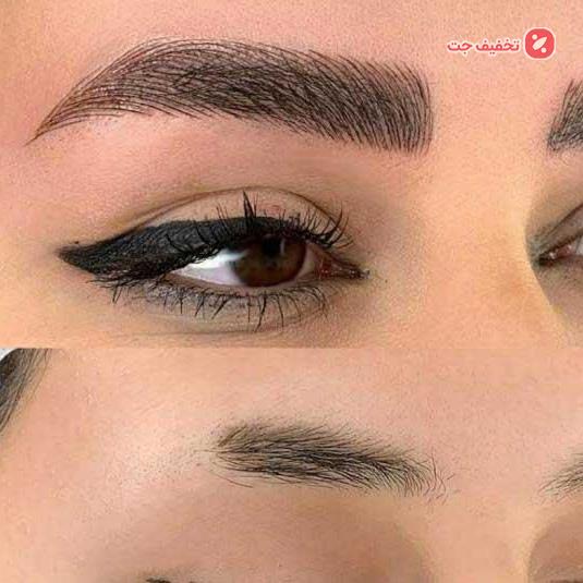 خدمات میکروبیلدینگ و زیبایی